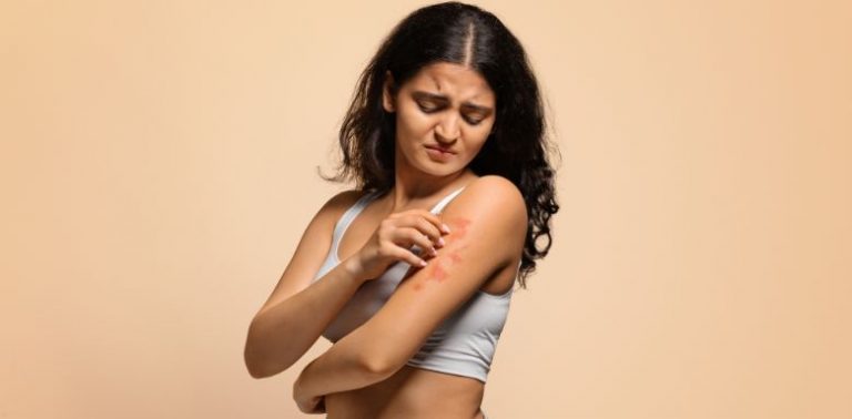 A woman in a white sports bra scratching a psoriasis rash on her arm.