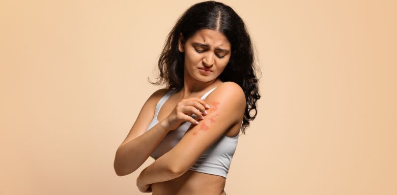 A woman in a white sports bra scratching a psoriasis rash on her arm.